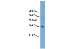 GALE antibody used at 0. (GALE Antikörper  (Middle Region))