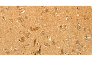 Immunohistochemistry of paraffin-embedded Human brain using CFHR1 Polyclonal Antibody at dilution of 1:40 (CFHR1 Antikörper)