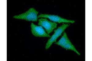 ICC/IF analysis of MAT2A in HeLa cells line, stained with DAPI (Blue) for nucleus staining and monoclonal anti-human MAT2A antibody (1:100) with goat anti-mouse IgG-Alexa fluor 488 conjugate (Green). (MAT2A Antikörper  (AA 1-395))