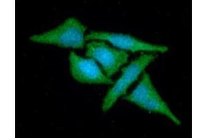 ICC/IF analysis of MAT2A in HeLa cells line, stained with DAPI (Blue) for nucleus staining and monoclonal anti-human MAT2A antibody (1:100) with goat anti-mouse IgG-Alexa fluor 488 conjugate (Green). (MAT2A Antikörper)