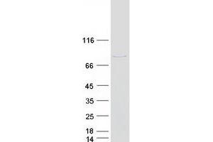Western Blotting (WB) image for Poly A Specific Ribonuclease (PARN) (Transcript Variant 1) protein (Myc-DYKDDDDK Tag) (ABIN2728260)