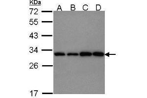 WB Image Sample (30 ug of whole cell lysate) A: 293T B: A431 , C: JurKat D: Raji 12% SDS PAGE antibody diluted at 1:1000 (PGAM1 Antikörper)