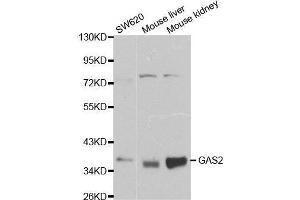 GAS2 Antikörper  (AA 1-100)