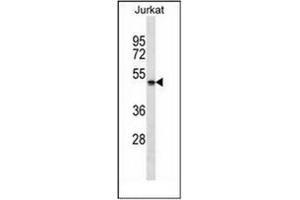Western blot analysis of NBPF5 Antibody (C-term) in Jurkat cell line lysates (35ug/lane). (NBPF5 Antikörper  (C-Term))