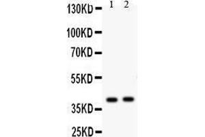 Anti- NDRG2 antibody, Western blotting All lanes: Anti NDRG2  at 0. (NDRG2 Antikörper  (C-Term))