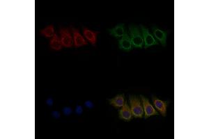 ABIN6261408 and ABIN6266511 staining HepG2 cells(30 min of 4uM Forskolin treatment) by IF/ICC.