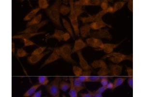 Immunofluorescence analysis of HeLa cells using UGT2B7 Polyclonal Antibody at dilution of 1:100 (40x lens). (UGT2B7 Antikörper)
