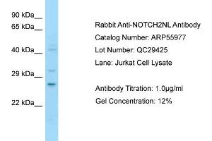 Western Blotting (WB) image for anti-Notch 2 N-terminal Like (NOTCH2NL) (C-Term) antibody (ABIN2786463) (NOTCH2NL Antikörper  (C-Term))