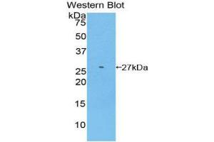 Western Blotting (WB) image for anti-Glutathione S-Transferase mu 2 (Muscle) (GSTM2) (AA 5-202) antibody (ABIN1859092) (GSTM2 Antikörper  (AA 5-202))
