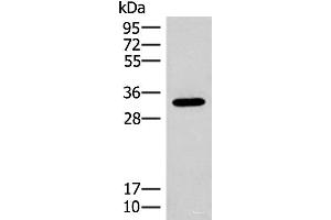 Western blot analysis of Mouse liver tissue lysate using RGR Polyclonal Antibody at dilution of 1:300 (RGR Antikörper)