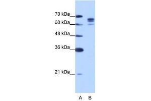 DDX17 antibody used at 1. (DDX17 Antikörper)