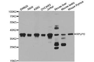 Western Blotting (WB) image for anti-Ribosomal Protein, Large, P0 (RPLP0) antibody (ABIN1876737)
