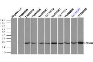 Image no. 4 for anti-Crystallin, alpha B (CRYAB) antibody (ABIN1497646) (CRYAB Antikörper)
