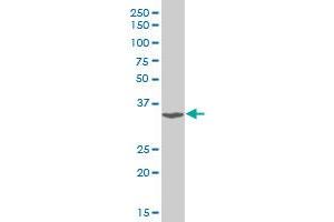 TSC22D3 polyclonal antibody (A01), Lot # 051018JC01. (TSC22D3 Antikörper  (AA 1-97))