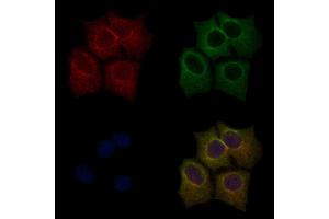 ABIN6255701 and ABIN6267554 staining HepG2 cells(30 min of 4uM Forskolin treatment) by IF/ICC. (LIM Domain Kinase 1 Antikörper  (pThr508))