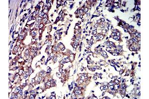 Immunohistochemistry (IHC) image for anti-Pyrimidinergic Receptor P2Y, G-Protein Coupled, 4 (P2RY4) antibody (ABIN5611351)