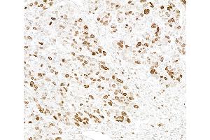 Immunohistochemistry (IHC) image for anti-Bromodomain PHD Finger Transcription Factor (BPTF) (AA 1350-1400) antibody (ABIN7454704)