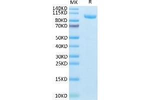 SDS-PAGE (SDS) image for LI Cadherin (AA 26-786) protein (His tag) (ABIN7274316)