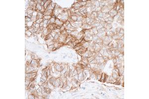 Immunohistochemistry (IHC) image for anti-Poliovirus Receptor (PVR) (AA 28-329) antibody (ABIN7449549) (Rekombinanter Poliovirus Receptor Antikörper  (AA 28-329))