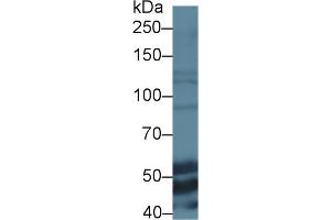 Western blot analysis of Mouse Liver Lysate, using anti-Mouse ELN Antibody (1 μg/ml) and HRP-conjugated Goat Anti-Rabbit antibody (abx400043, 0.