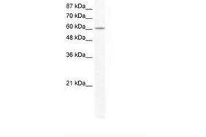 Image no. 1 for anti-Far Upstream Element (FUSE) Binding Protein 1 (FUBP1) (AA 201-250) antibody (ABIN202846) (FUBP1 Antikörper  (AA 201-250))