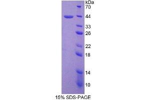 SDS-PAGE analysis of Human SPD Protein.