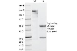 SDS-PAGE (SDS) image for anti-Lectin, Galactoside-Binding, Soluble, 13 (LGALS13) (AA 23-134) antibody (ABIN6939562)