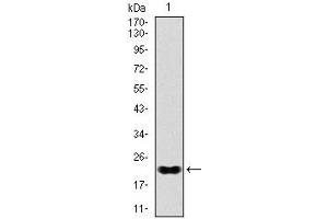 Western blot analysis using NKX2. (Nkx2-2 Antikörper)
