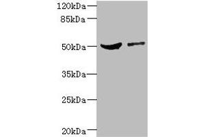 Western blot All lanes: CPN1 antibody at 6. (CPN1 Antikörper  (AA 209-458))