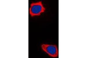 Immunofluorescent analysis of COX17 staining in HepG2 cells.
