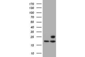 Western Blotting (WB) image for anti-Proteasome (Prosome, Macropain) Subunit, beta Type, 9 (Large Multifunctional Peptidase 2) (PSMB9) (AA 21-219) antibody (ABIN1491194) (PSMB9 Antikörper  (AA 21-219))
