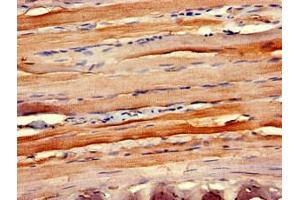 Immunohistochemistry of paraffin-embedded human skeletal muscle tissue using ABIN7145918 at dilution of 1:100 (CCR1 Antikörper  (AA 314-362))