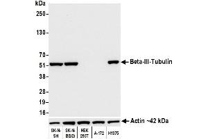 Western Blotting (WB) image for anti-Tubulin, beta 3 (TUBB3) (AA 400-450) antibody (ABIN7453957)