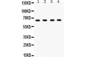 Western Blotting (WB) image for anti-Amyloid beta (A4) Precursor Protein-Binding, Family B, Member 1 (Fe65) (APBB1) (AA 21-56), (N-Term) antibody (ABIN3043784)