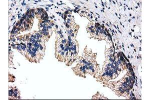 Immunohistochemical staining of paraffin-embedded Human prostate tissue using anti-FAM40A mouse monoclonal antibody. (STRIP1 Antikörper)