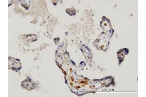 Immunoperoxidase of monoclonal antibody to MKNK1 on formalin-fixed paraffin-embedded human placenta. (MKNK1 Antikörper  (AA 1-465))