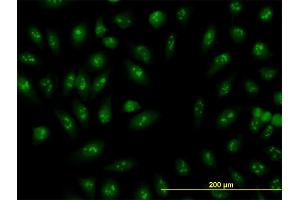 Immunofluorescence (IF) image for anti-Ribosomal RNA Processing 9, Small Subunit (SSU) Processome Component, Homolog (RRP9) (AA 1-475) antibody (ABIN563952)
