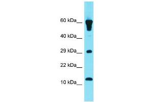 Host: Rabbit Target Name: GCSAML Sample Type: Fetal Heart lysates Antibody Dilution: 1.