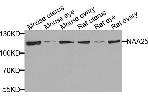 Western blot analysis of extracts of various cells, using NAA25 antibody. (NAA25 Antikörper)