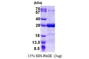 SDS-PAGE (SDS) image for Synaptosomal-Associated Protein, 25kDa (SNAP25) protein (His tag) (ABIN666858) (SNAP25 Protein (His tag))