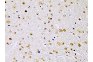 Immunohistochemistry of paraffin-embedded mouse brain using IKKβ antibody (ABIN3022875, ABIN3022876, ABIN3022877 and ABIN6219275) at dilution of 1:100 (40x lens). (IKBKB Antikörper  (AA 630-730))
