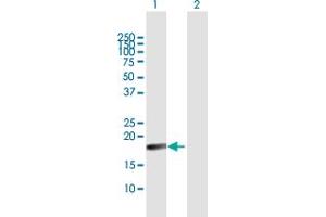 Western Blot analysis of TNFSF18 expression in transfected 293T cell line by TNFSF18 MaxPab polyclonal antibody. (TNFSF18 Antikörper  (AA 1-177))