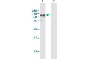 Western Blot analysis of HIP1R expression in transfected 293T cell line by HIP1R MaxPab polyclonal antibody. (HIP1R Antikörper  (AA 1-1068))
