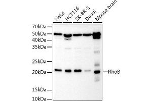 Western blot analysis of extracts of various cell lines, using RhoB Rabbit pAb antibody (ABIN3016775, ABIN3016776, ABIN3016777 and ABIN6219838) at 1:1000 dilution.