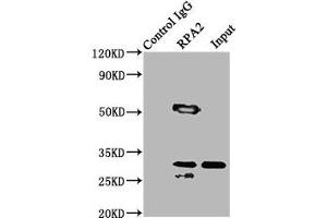Immunoprecipitating RPA2 in Hela whole cell lysate Lane 1: Rabbit control IgG (1 μg) instead of ABIN7167697 in Hela whole cell lysate.