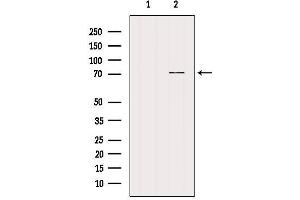 Western blot analysis of extracts from Rat heart, using NRXN3 Antibody. (Neurexin 3 Antikörper  (N-Term))