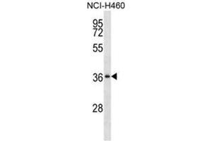 Western blot analysis of SERPINB1 Antibody (Center) Cat. (SERPINB1 Antikörper  (Middle Region))