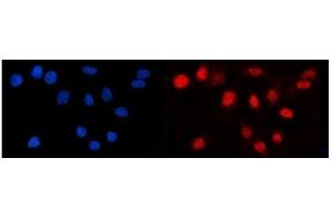 IF analysis of LEF1 using anti-LEF1 antibody (ABIN7600016). (LEF1 Antikörper  (AA 14-274))