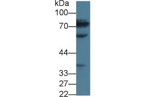 Detection of MTHFR in Human Jurkat cell lysate using Polyclonal Antibody to Methylenetetrahydrofolate Reductase (MTHFR) (MTHFR Antikörper  (AA 1-325))