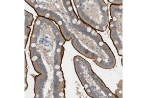 Immunohistochemical staining of human duodenum with PRRG4 polyclonal antibody  shows strong membranous(luminal) and moderate cytoplasmic positivity in glandular cells. (PRRG4 Antikörper)